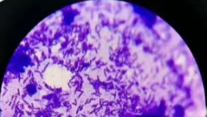 Introduction of  Bacillus coagulans
