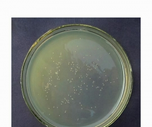 Bacillus laterosporus