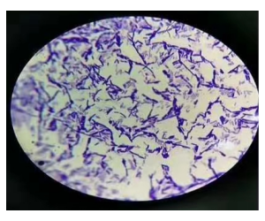 Clostridium Butyricum