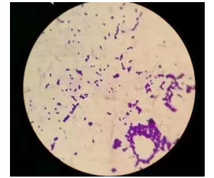 Enterococcus faecalis