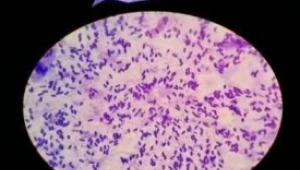 Why can biological fungus fertilizer change soil to raise root?